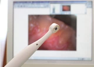 お口の中を拡大して写すカメラで、実際にお口の中を確認していただけます。患者さんとモニターを見ながら説明をおこないます。