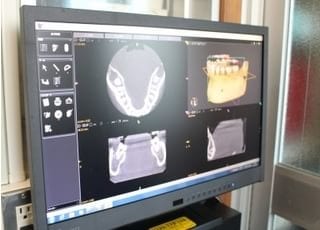 レントゲンで撮影しましたら、こちらで確認します。