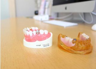 Bio Dental Clinic ASHIYA つめ物・かぶせ物
