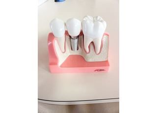 治療の説明等で使用いたします。