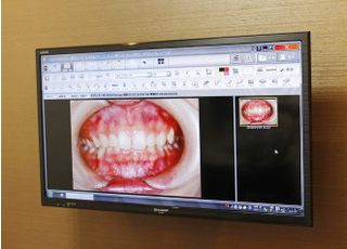お口の状態や治療内容が分りやすいように、口腔内の写真をお見せするようにしています。