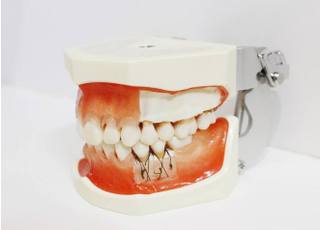 歯の模型です。