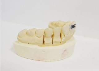 お口全体のバランスを考えて、詰め物や被せ物の治療を行っています。