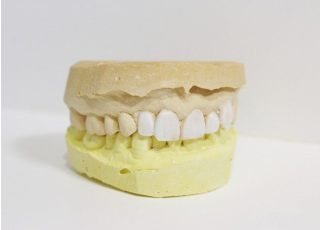 模型を使用してできるだけ分りやすく治療説明をおこなっております。