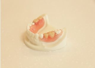 りえこ歯科矯正歯科クリニック 入れ歯・義歯