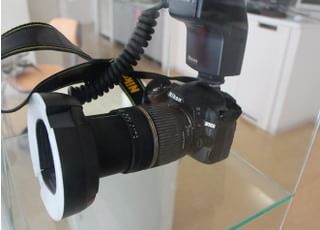 口腔内カメラでお口の中をモニターでご覧いただけます