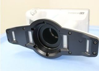 口腔外カメラで、ご自身では確認できない治療の経過を確認いただけます。