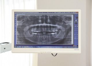 丸山歯科医院 歯周病