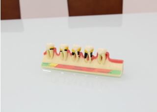 説明の際には視覚的にも分かるよう模型を使用することもあります。