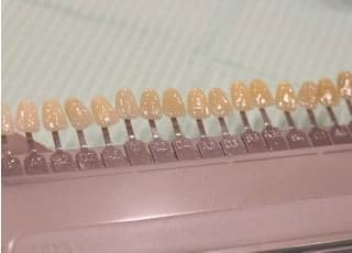 ホワイトニングも患者さまと色味をお話ししつつ、進めていきます。