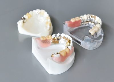 Q.入れ歯を作製した後も、継続して修理や調整に対応してもらえますか？