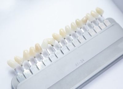 ホワイトニングで美しく健康的な白い歯を一緒に目指しましょう