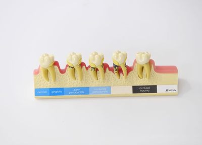 そう歯科クリニック 歯周病
