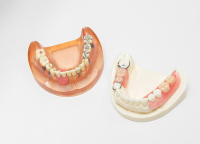 快適に過ごすための機能性を重視した入れ歯をご提供しています