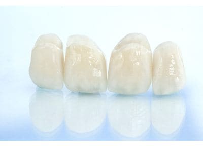 医療法人とくつファミリー歯科クリニック つめ物・かぶせ物