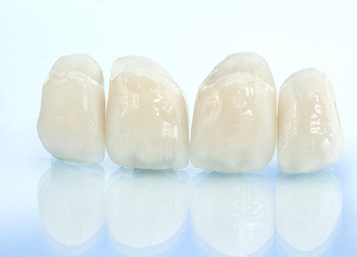 白木原歯科 メタルフリー治療