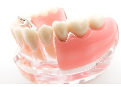 松原歯科クリニック 入れ歯・義歯