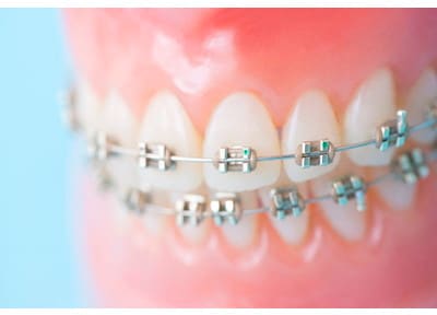 にこ歯科クリニック（埼玉県ふじみ野市） 矯正歯科