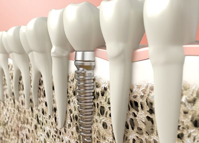 可能な限りリスクを排除した治療をご提案いたします