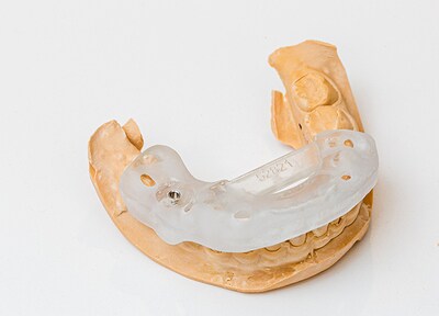 CT撮影・ステント作製