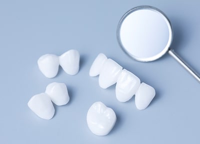 アバットメント装着