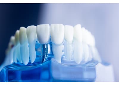 医療法人　健真会　藤本歯科クリニック インプラント