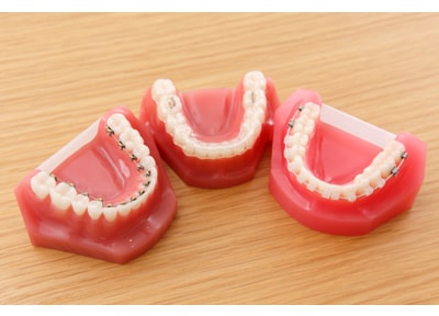 三軒茶屋矯正歯科クリニック 矯正歯科