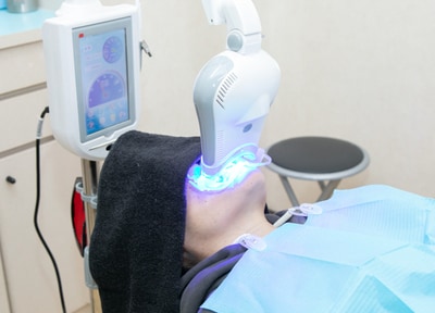 オフィスホワイトニング