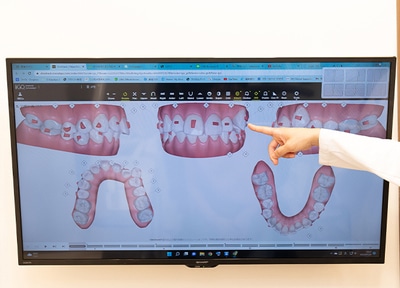 3D画像で治療後の状態がイメージできます