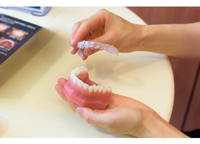 コンサルテーション