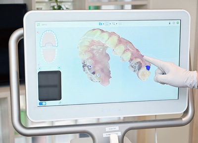 歯科医師と歯科衛生士の連携が取れたスムーズな治療