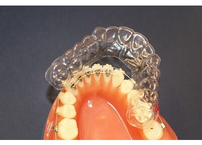 矯正歯科の治療内容 代々木駅前歯科 渋谷区 代々木駅 Epark歯科