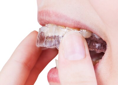 装置装着期間中