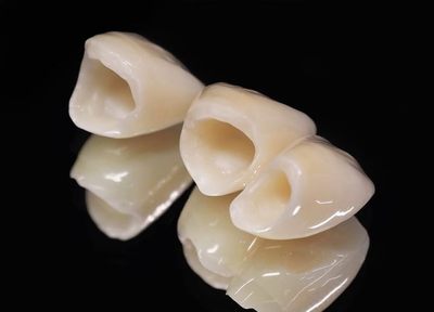 見た目も機能面も優れたセラミック