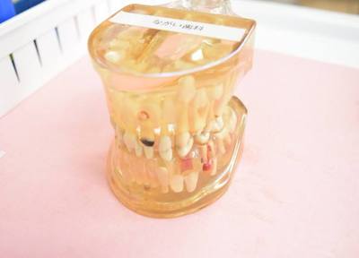患者さまに合った入れ歯をさまざまな種類のなかからご提案します