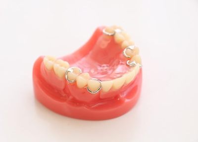 今お持ちの入れ歯の調整も対応！違和感のない入れ歯のために「微調整」を細かく行います