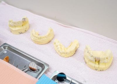Q.歯を失った患者さまに入れ歯をおすすめする理由は何ですか？
