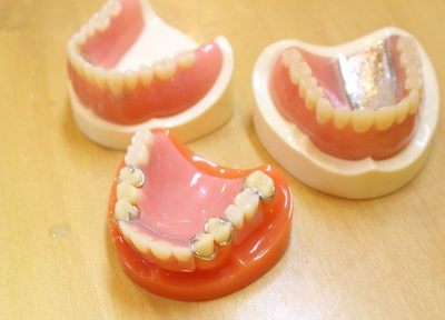 合うまで調整を続けるなど、責任を持った入れ歯作製にこだわっています