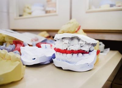 平井歯科医院 入れ歯・義歯