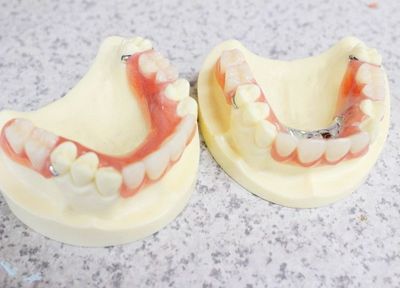 外れやすい入れ歯に悩まれている方！当院の入れ歯は、食事中に動きにくいのが大きな特徴です。