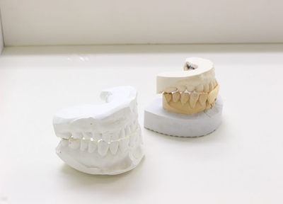 熱が伝わりやすい入れ歯や、金属のバネがない入れ歯をご用意！患者さまに選んでいただきます