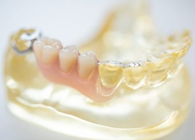 Q.入れ歯治療で重視しているポイントを教えてください。