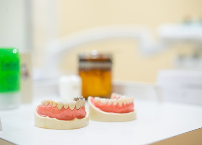 Q.入れ歯作りで注意していることはありますか？