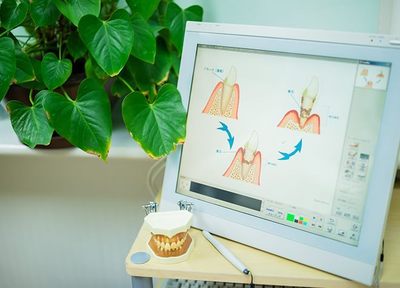 歯周病を予防するためのアドバイス