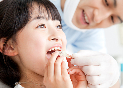 マウスピースに見た目にも配慮された治療。小さいうちに歯の矯正をすることで、将来の抜歯リスクを抑えることができます。