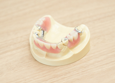 介護を必要とする方の義歯治療には、入れ歯をおすすめします。