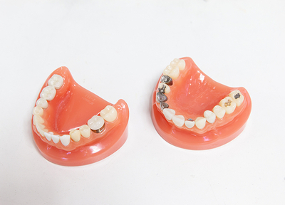 お口の形をトータルに判断しながら、歯科技工士とも連携して義歯等を制作しています