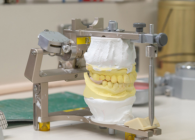 院内に歯科技工室があるため、つめ物・かぶせ物の調整をスムーズに行うことができます