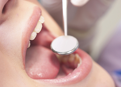 ノアデンタルクリニック 予防歯科