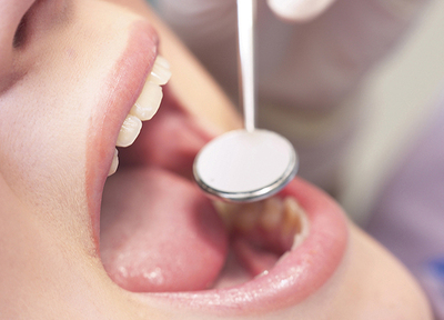 ご自身の歯を少しでも長く残すためにも歯周病の検査をしましょう